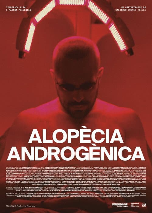 Alopècia androgènica afişi